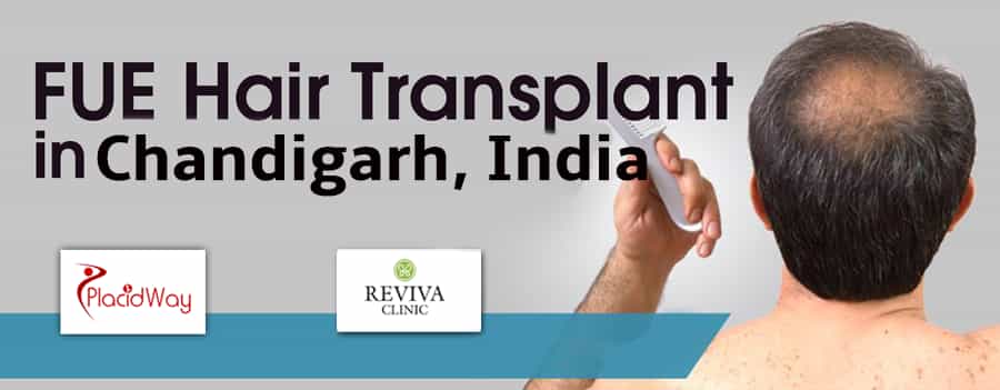 FUE Hair Transplant in Chandigarh, India by Reviva Clinic